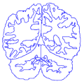 Neuromorphometrics logo